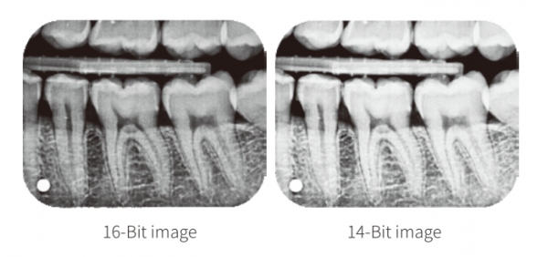 Imagerie (Digital dental CR imaging system ) – Image 4